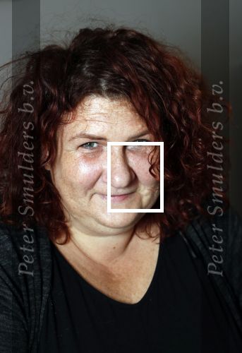 Amsterdam 4 oktober 2018
Bruni Heinke wordt behandels door Agniezka van Bodyfix.