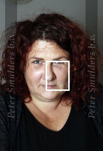 Amsterdam 4 oktober 2018
Bruni Heinke wordt behandels door Agniezka van Bodyfix.