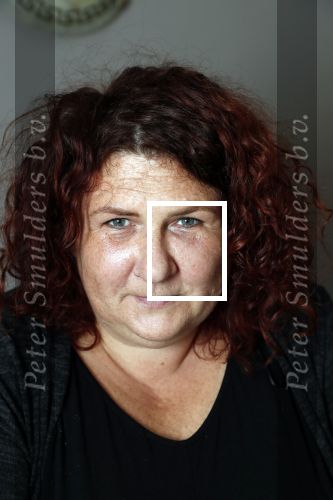 Amsterdam 4 oktober 2018
Bruni Heinke wordt behandels door Agniezka van Bodyfix.