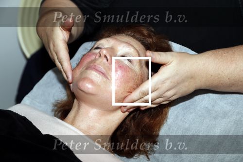 Amsterdam 4 oktober 2018
Bruni Heinke wordt behandels door Agniezka van Bodyfix.
