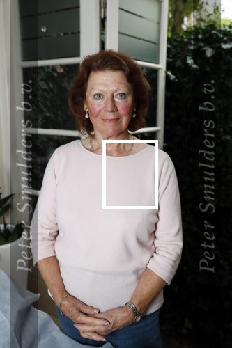 Amsterdam 4 oktober 2018
Bruni Heinke wordt behandels door Agniezka van Bodyfix.