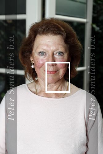 Amsterdam 4 oktober 2018
Bruni Heinke wordt behandels door Agniezka van Bodyfix.