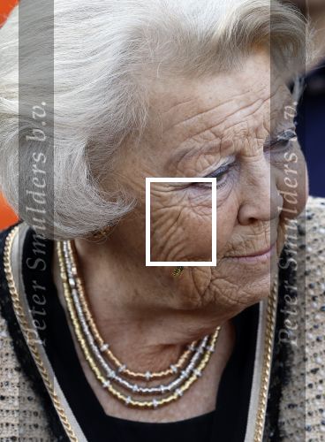 Soestdijk 5 oktober 2024
Prinses Beatrix woordt aangevallen door een wesp op paleis Soestdijk.