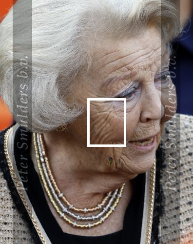 Soestdijk 5 oktober 2024
Prinses Beatrix woordt aangevallen door een wesp op paleis Soestdijk.