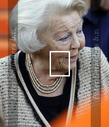 Soestdijk 5 oktober 2024
Prinses Beatrix woordt aangevallen door een wesp op paleis Soestdijk.