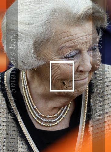 Soestdijk 5 oktober 2024
Prinses Beatrix woordt aangevallen door een wesp op paleis Soestdijk.