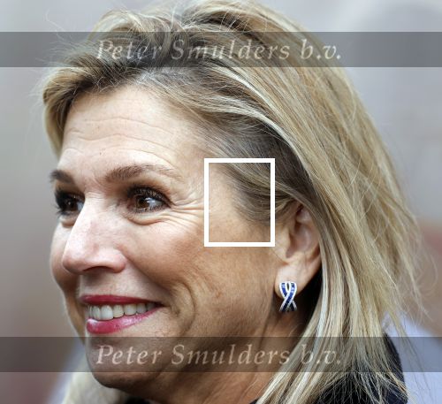 Utrecht 8 oktober 2025
Hare Majesteit Koningin Maxima, erevoorzitter van stichting MIND Us, lanceerde vandaag het digitale platform In je bol in Utrecht
