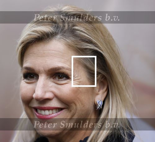 Utrecht 8 oktober 2025
Hare Majesteit Koningin Maxima, erevoorzitter van stichting MIND Us, lanceerde vandaag het digitale platform In je bol in Utrecht
