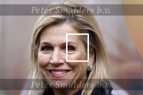 Utrecht 8 oktober 2025
Hare Majesteit Koningin Maxima, erevoorzitter van stichting MIND Us, lanceerde vandaag het digitale platform In je bol in Utrecht