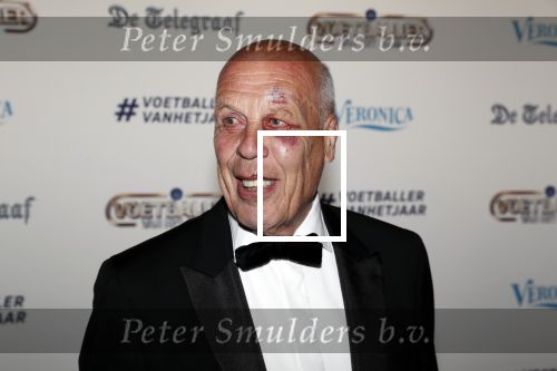 Hilversum 2 september 2019
Voetbalgala bij studio 21 . Jan Smit met blauw oog