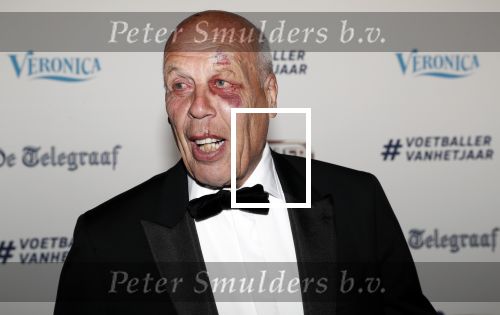 Hilversum 2 september 2019
Voetbalgala bij studio 21 . Jan Smit met blauw oog