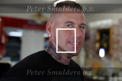 Eindhoven 28 augustus 2018
Rolf Tangel laat bij Dannyâ€™s tattooshop in Eindhoven zijn Barbie Samantha tatoos weghalen.