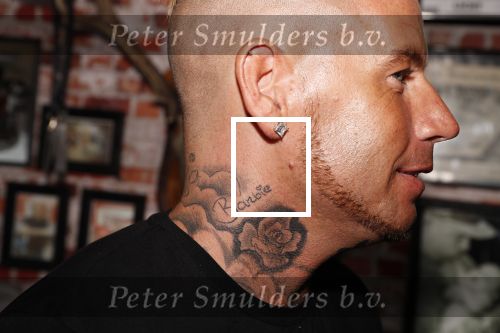 Eindhoven 28 augustus 2018
Rolf Tangel laat bij Dannyâ€™s tattooshop in Eindhoven zijn Barbie Samantha tatoos weghalen.