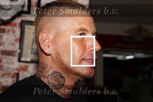 Eindhoven 28 augustus 2018
Rolf Tangel laat bij Dannyâ€™s tattooshop in Eindhoven zijn Barbie Samantha tatoos weghalen.