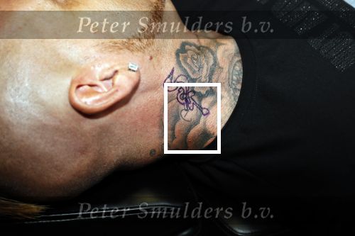 Eindhoven 28 augustus 2018
Rolf Tangel laat bij Dannyâ€™s tattooshop in Eindhoven zijn Barbie Samantha tatoos weghalen.