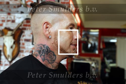Eindhoven 28 augustus 2018
Rolf Tangel laat bij Dannyâ€™s tattooshop in Eindhoven zijn Barbie Samantha tatoos weghalen.